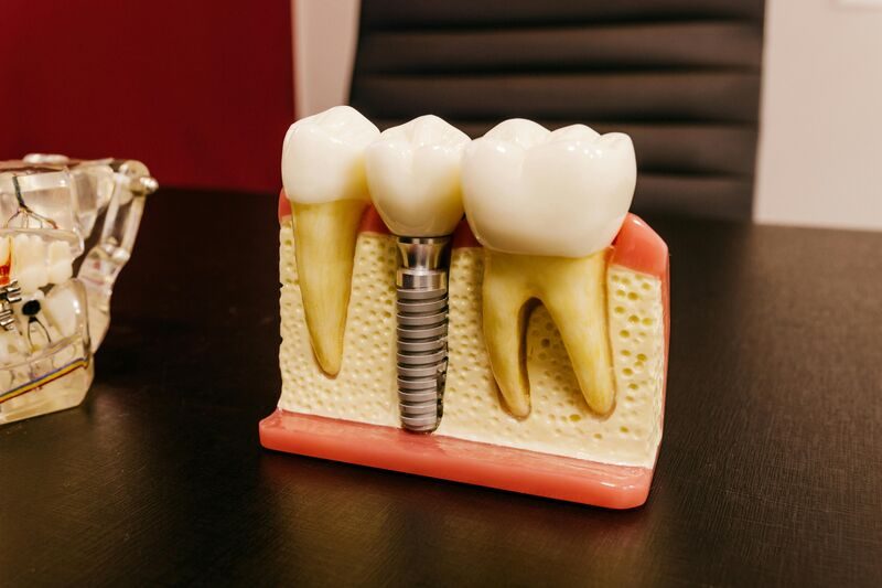 Dr. Neetu Tanwani discussing dental implant treatment with a patient in Thaltej, Ahmedabad